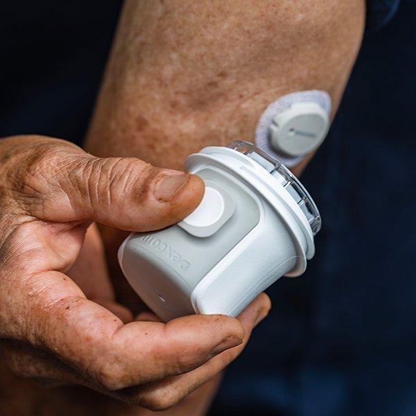 Obtenez du soutien pour insérer votre SCG Dexcom ou pour résoudre un problème technique.